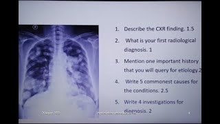 OSPE on Metastasis in Lung [upl. by Edroi13]