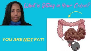 You are not FAT What do you Have Sitting in Your COLON [upl. by Essilec349]