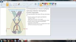 Psychology 306 Biopsychology  Chapter 16 Commissurotomy in Human Epileptics [upl. by Treblihp339]