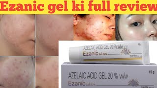 How To Use Azelaic Acid 4 Mistakes To Avoid For Best Results  Dr Sam Bunting [upl. by Yusuk]