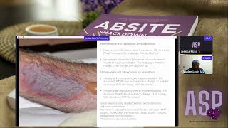 Episode 88 ABSITE CT Surgery Review From ABSITE Smackdown Highlights Conference [upl. by Zzahc84]