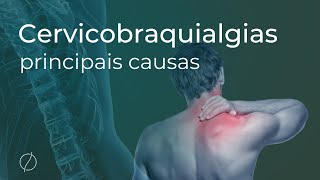 Principais causas das Cervicobraquialgias  dor que irradia do pescoço para o braço [upl. by Okorih467]