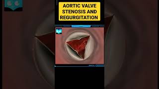 Aortic value stenosis and regurgitation studyanimated biology animation science [upl. by Nnylsaj]