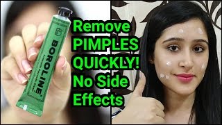 Remove PIMPLES amp ACNE IN 3 DAYS  NATURAL amp EASY METHOD [upl. by Leima456]