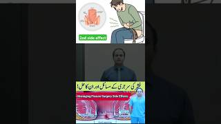 Managing Fissure Surgery Side Effects drimtiazhussain viralshorts [upl. by Yhtnomit908]