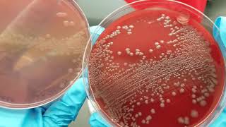 Microbiology Urine Culture Primary SetUp Inoculation and Colony Count [upl. by Acnayb998]