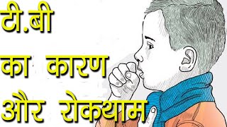 टीबी का कारण और रोकथाम  TB ka desi ilaaz  Tips for Tuberculosis Patient  Ayurvedic Samadhan [upl. by Adnaugal]