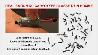 Caryotype humain classé protocole technique Cytogénétique [upl. by Carrew226]