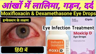 moxi d eye drops hindi  moxifloxacin and dexamethasone eye drops  moxicip eye drops in hindi [upl. by Felizio410]