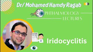 Uvea 2 Iridocyclitis [upl. by Rubina]