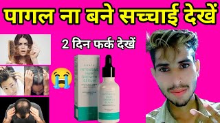 arata intensive hair growth serum reviewusesside effectsarata hair growth serum [upl. by Gunas949]