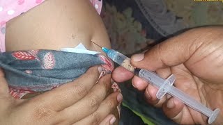 IM Intramuscular Arm injection PushPheniramine Meleate Avil 24 Ep 121 Anik Health Tips [upl. by Jarl]