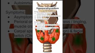 Hypoparathyroidism [upl. by Odlabso]