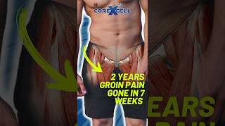 2 Years of Groin Pain gone in 7 weeks [upl. by Catina]