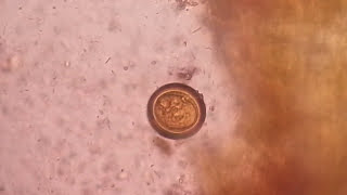 Egg of tapeworm or Taenia under the Microscope of saline preparation [upl. by Brianna28]