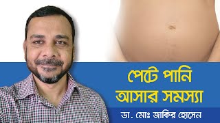 Ascites Treatment  How is ascites treated  পেটে পানি আসলে করণীয়  পেটে পানি জমার লক্ষণ [upl. by Leonardi]