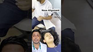 Nose alignment chiropractic treatment indianchiropractor beauty indianchiropractic chiropractor [upl. by Almeda]