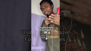 Witch Hazel For Ear Pimples [upl. by Hebrew]