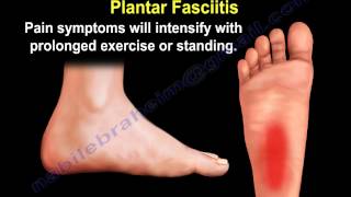 Heel Pain amp The Baxters Nerve  Everything You Need To Know  Dr Nabil Ebraheim [upl. by O'Grady]