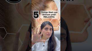 Melasma  What increases pigmentation  Melasma treatment by Dermatologist  Melasma Skincare [upl. by Ennairam329]