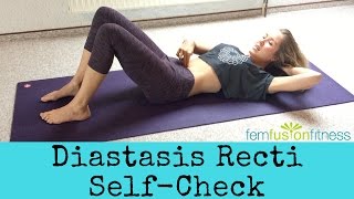 How To Test for Diastasis Recti [upl. by Zaragoza]