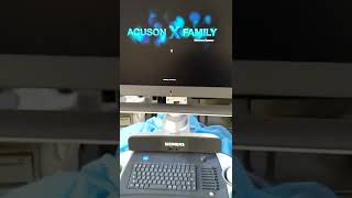 Siemens Acuson X700 Ultrasound [upl. by Amity]