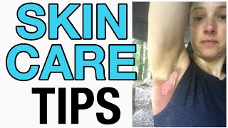 RADIATION SKINCARE Tips Breast Cancer [upl. by Ymmik]