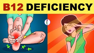 Vitamin B12 Deficiency Symptoms  B12 Deficiency  Vitamin B12  All You Need to Know [upl. by Suoirtemed7]