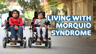 My Story  Living with Morquio syndrome [upl. by Nanor512]