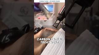 The Benefits of Carbon Facial with Dr Gautam Rekhi carbonfacial lasertreatment [upl. by Duky]