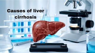 What causes liver cirrhosis Key risk factors explained [upl. by Hayward48]