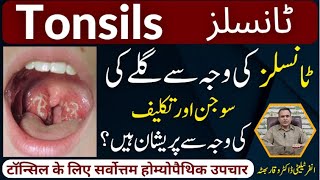 Tonsils گلے کی سوجن اور تکلیف टॉन्सिल Homeopathic Treatmennt By Dr Waqar Bhutta In Urdu  Hindi [upl. by Gellman]