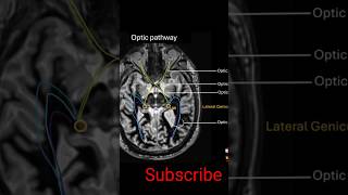 Optic Pathway anatomy shorts mri [upl. by Carr257]