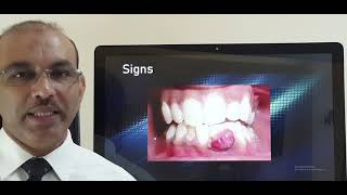 Pyogenic granuloma gums Patient teaching programme Malayalam [upl. by Oznol86]