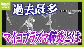 【マイコプラズマ肺炎って？】８年ぶり感染拡大で『過去最多』症状消えても感染力あり「歩く肺炎」とも 実は「うがい」はあまり予防効果なし！？（2024年10月9日） [upl. by Adrea961]