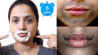 ಬಾಯಿ ಸುತ್ತಾ ಕಪ್ಪಾಗಿದ್ದರೆ ಇಲ್ಲಿದೆ ಮನೆ ಮದ್ದು  Remove Dark Spots Black Patches Around Mouth In 5 Days [upl. by Ringsmuth939]