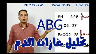 ازاى تقرا غازات الدم HOT TO INTERPRET ABG [upl. by Aehc]