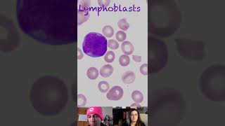 Lymphoblast Morphological Characteristics [upl. by Erdna]