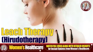 🐍Leech Therapy  10 Benefits You Wont Believe 💉✨ [upl. by Oilejor]