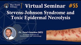 StevensJohnson syndrome and toxic epidermal necrolysis  Dr Yared Getachew  Blue Health [upl. by Beitnes]