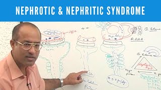 Nephrotic and Nephritic Syndrome  Causes Symptoms amp Treatment🩺 [upl. by Ahrens]