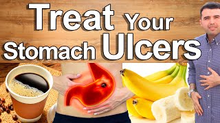 Do This And Cure Your Stomach Pain Gastritis and Ulcers  Best Natural Treatment of Stomach Pain [upl. by Bertasi594]