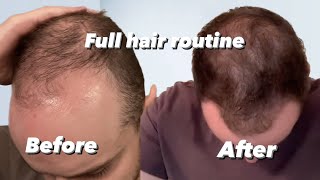 The Hair routine that saved my hair… Reversing hair loss EP 2 [upl. by Balf144]