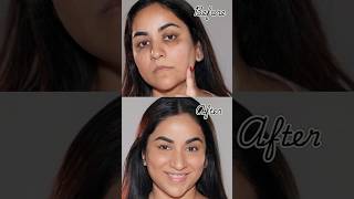 NO Foundation amp Concealer How to Cover Dark Circles Spots amp Scars [upl. by Uuge]