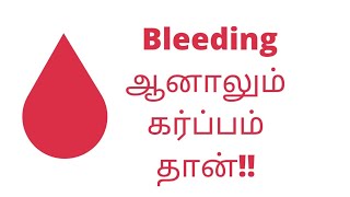 Implantation bleeding symptoms in tamil  implantation spotting identification  Puguntha veedu [upl. by Annonyw]