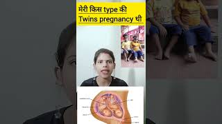 meri kis type ki twins pregnancy thi dichorionic diamniotic twins pregnancy ka kya matlab hota hai [upl. by Girvin]