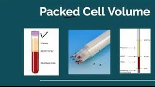 HCT Hematocrit Test PCV Packed cell Volume Test [upl. by Atikahs]