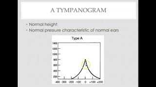 Tympanometry interpretation [upl. by Dlopoel]