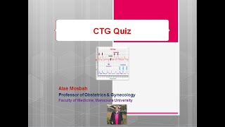 CTG Quiz [upl. by Ani]