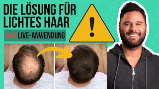 Die Lösung für lichtes Haar Live Anwendung [upl. by Edualcnaej]